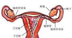 你了解输卵管性不孕症吗？大部分不孕症出自输卵管？