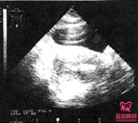 B超对试管婴儿宝宝有辐射伤害吗？
