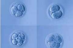 俄罗斯试管婴儿胚胎等级划分怎么回事