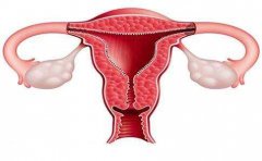 子宫内膜增生能选择试管婴儿助孕吗？