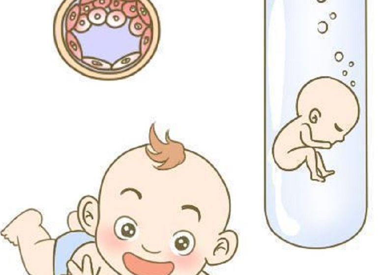 试管婴儿