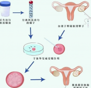试管婴儿移植第七天肚子痛